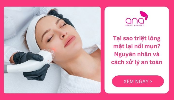 Tại sao triệt lông mặt lại nổi mụn