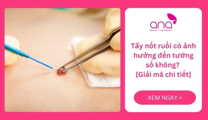 Tẩy nốt ruồi có ảnh hưởng đến tướng số không
