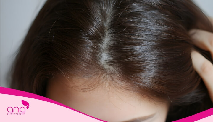 Gội đầu với lá tía tô thường xuyên giúp da đầu sạch sâu mà không gây khô hay kích ứng