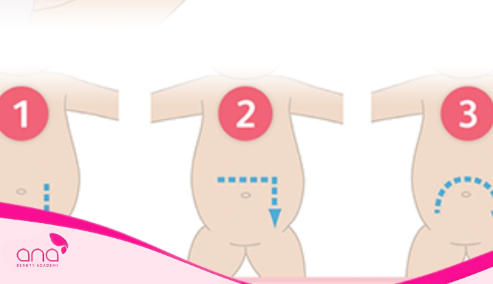 Massage-I-L-U-giup-chuyen-hoi-va-thuc-an-du-thua-nhanh-hon