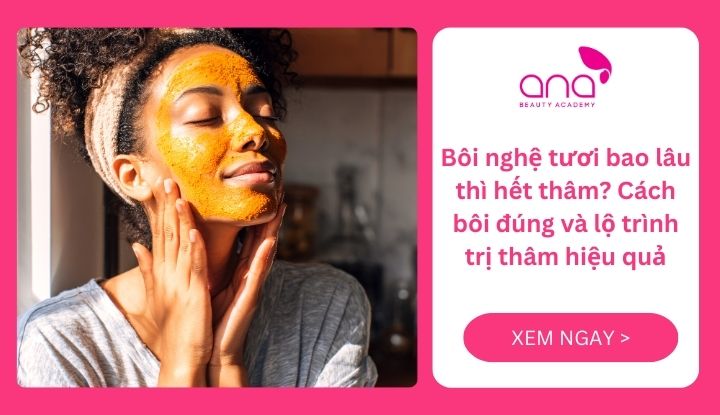 Bôi nghệ tươi bao lâu thì hết thâm