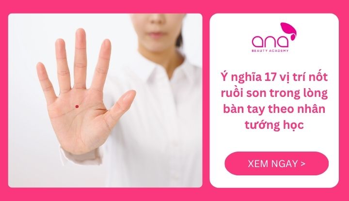 Nốt ruồi son trong lòng bàn tay