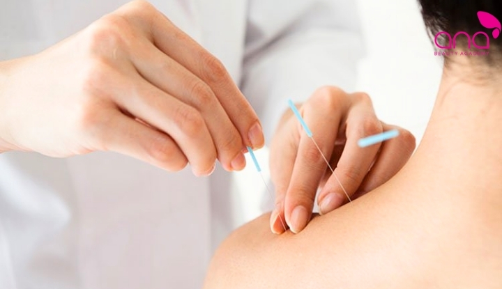 Giai đoạn nặng cần phương pháp điều trị chuyên sâu