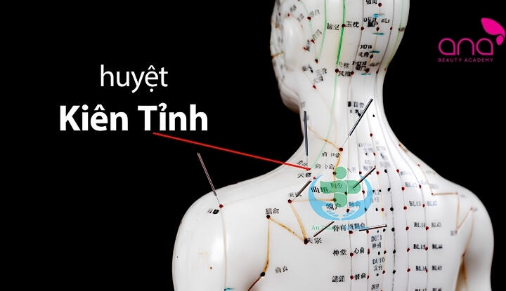 huyệt kiên tỉnh