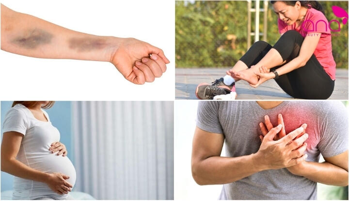 Một số đối tượng cần thận trọng hoặc hạn chế sử dụng