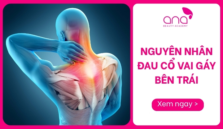 nguyên nhân đau cổ vai gáy bên trái