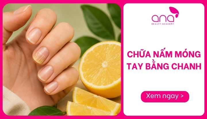 chữa nấm móng tay bằng chanh
