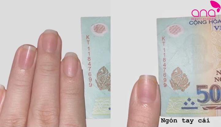 Đo móng bằng ảnh chụp