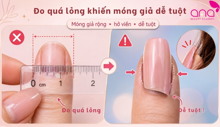 Đo móng quá lỏng