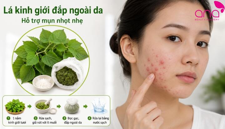 Kinh giới trị mụn nhọt