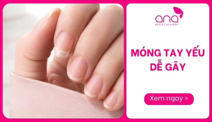 móng tay yếu dễ gãy