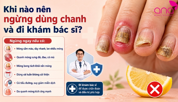 nấm móng cần đi khám