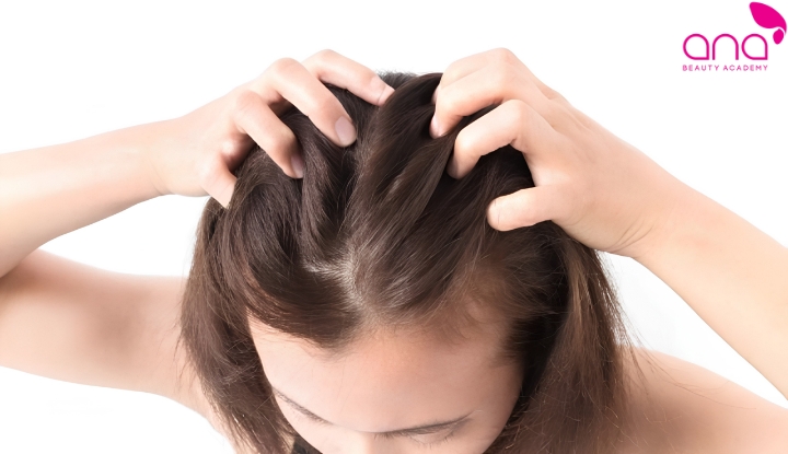 Stress và nội tiết gây ngứa da đầu